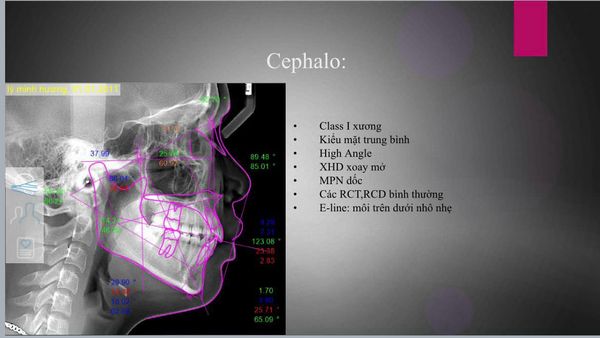 Nha Khoa Hoà Việt Mỹ   CẦN TUYỂN:  - Bác Sĩ - Y sĩ RHM - Lễ Tân - Trợ thủ nha khoa.