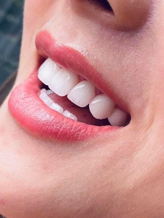 Nha khoa  Thiện tâm cần tuyển 2 bạn đứng ghế , 2 bạn phụ tá nha khoa