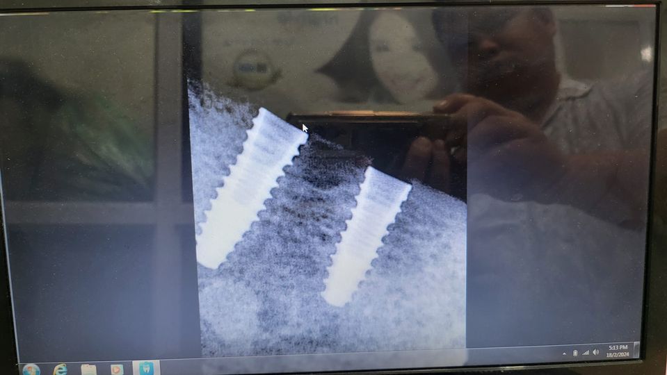 Cần tuyển y tá phụ có kinh nghiệm làm được cơ bản