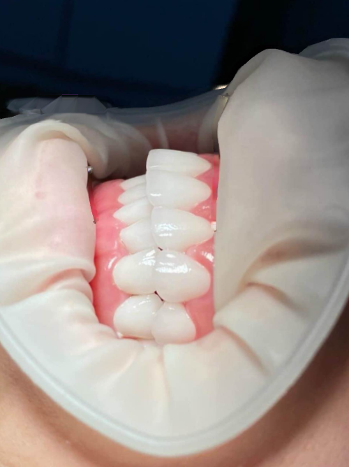 Nha khoa  Thiện tâm cần tuyển 2 bạn đứng ghế , 2 bạn phụ tá nha khoa