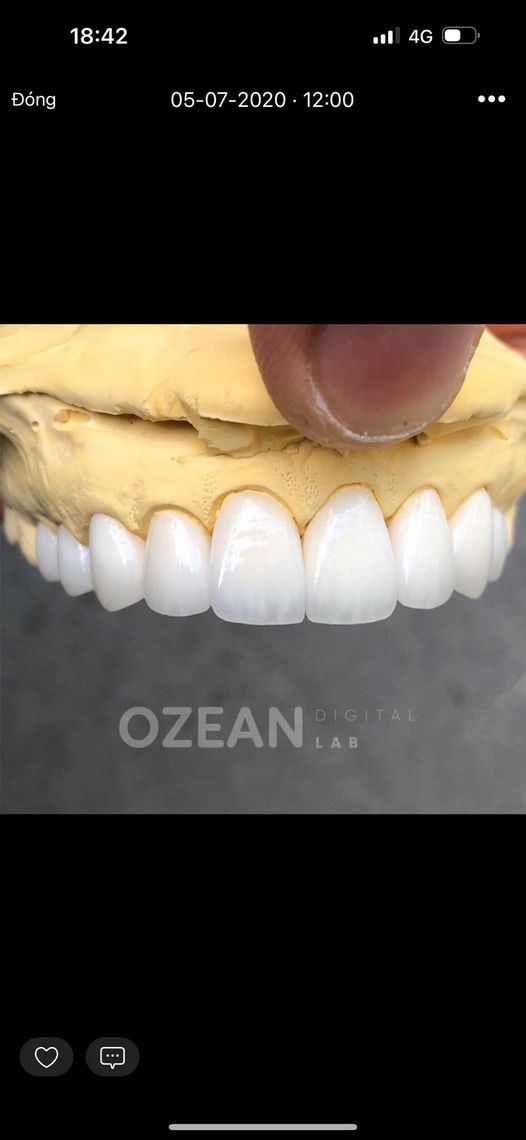  TUYỂN DỤNG NHA KHOA - KHÁM PHÁ CƠ HỘI TẠI NHA KHOA DR ST &amp; CỘNG SỰ