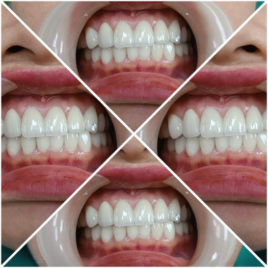 TUYỂN NHÂN VIÊN CHỐT SALE 