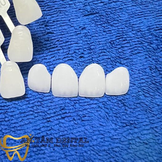  NHA KHOA AN TÂM CẦN TUYỂN