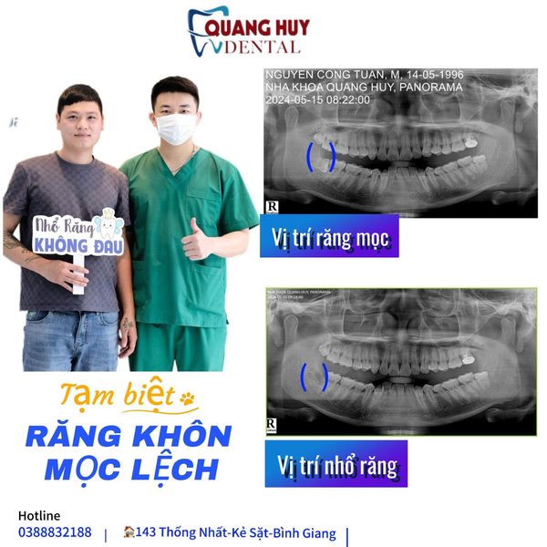  𝙂𝙤́𝙘 𝙏𝙪𝙮𝙚̂̉𝙣 𝙉𝙝𝙖̂𝙣 𝙎𝙪̛̣ 𝙋𝙝𝙤̀𝙣𝙜 𝙆𝙝𝙖́𝙢 :