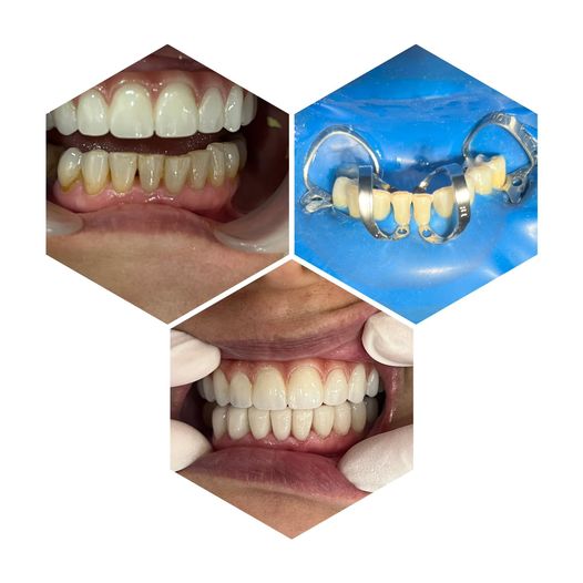 Cần tuyển gấp phụ tá nha khoa làm việc tại 72 vườn lài- quận 12( gần gò vấp)