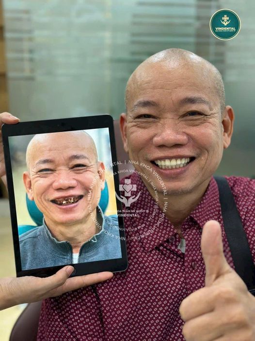 Nha khoa Vindental Luxury Cầu Giấy tuyển dụng: