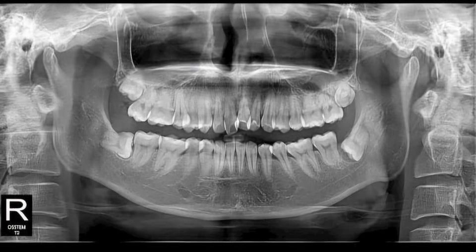 Cần tuyển dụng  vị trí:  - 1 Kĩ thuật viên biết các thủ thuật
