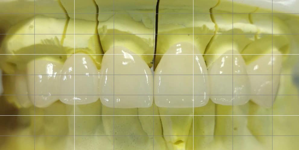 NHA KHOA HƯNG HIỆP TUYỂN DỤNG **PHỤ TÁ NHA KHOA