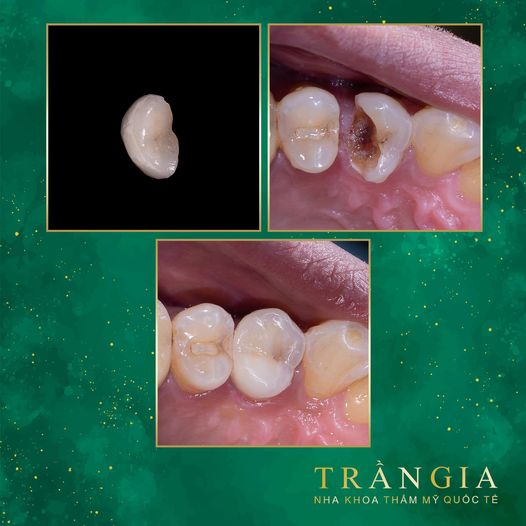 Nha khoa Trần Gia cần tuyển 2 nữ phụ tá. Yêu cầu : Có kinh nghiệm