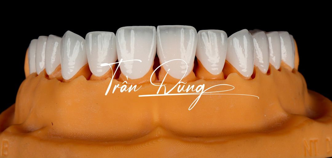 CẦN HỢP TÁC ĐIỀU TRỊ,PHỤ TÁ NHA KHOA 