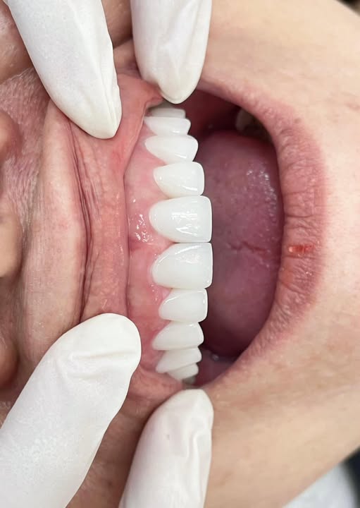 cần tuyển . - 3 Phụ tá ( ưu tiên có kinh nghiệm)