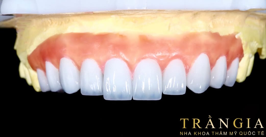 Nha khoa Trần Gia cần tuyển 2 nữ phụ tá.