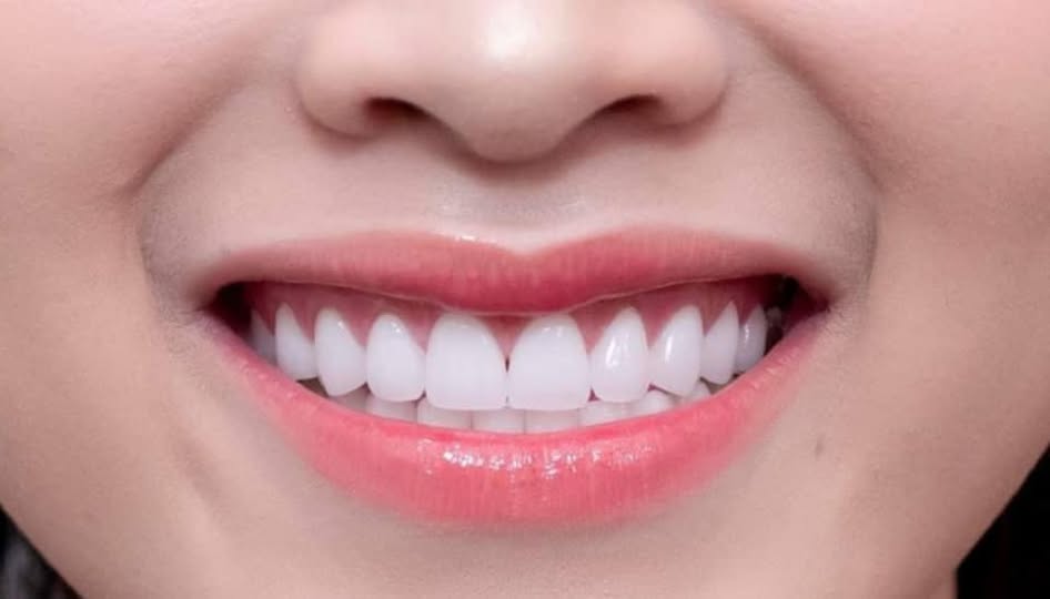 TUYỂN DỤNG : 05 y tá, điều dưỡng, KTV