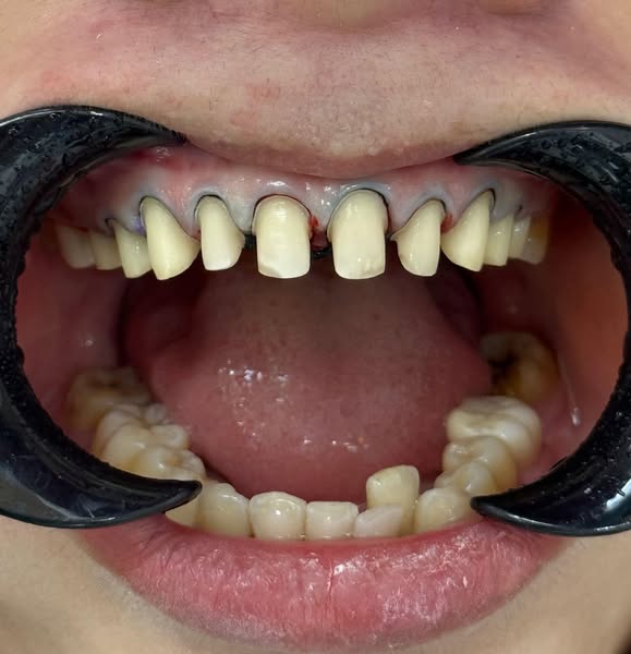 TUYỂN DỤNG NHÂN VIÊN NHA KHOA TUẤN QUỲNH