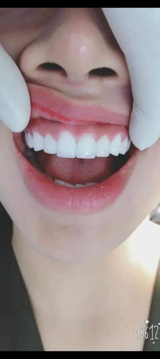 TUYỂN PHỤ TÁ, ĐIỀU TRỊ NỮ 