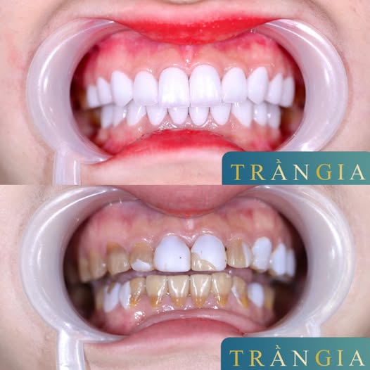 Nha khoa Trần Gia cần tuyển 2 nữ phụ tá.