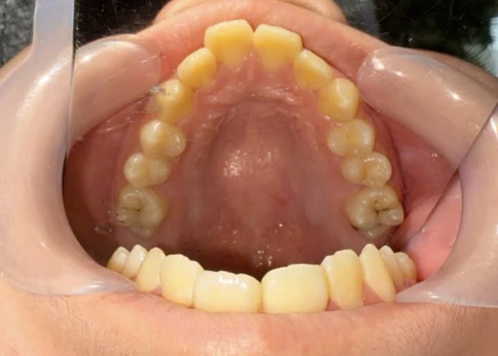 Nha khoa Thị Trấn Trảng Bom Tỉnh Đồng Nai Cần tuyển 1 Nam Bác Sĩ hoặc Y Sĩ RHM