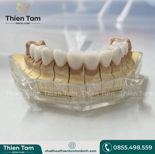 NHA KHOA CẦN TUYỂN: