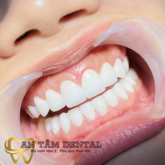 NHA KHOA AN TÂM CẦN TUYỂN