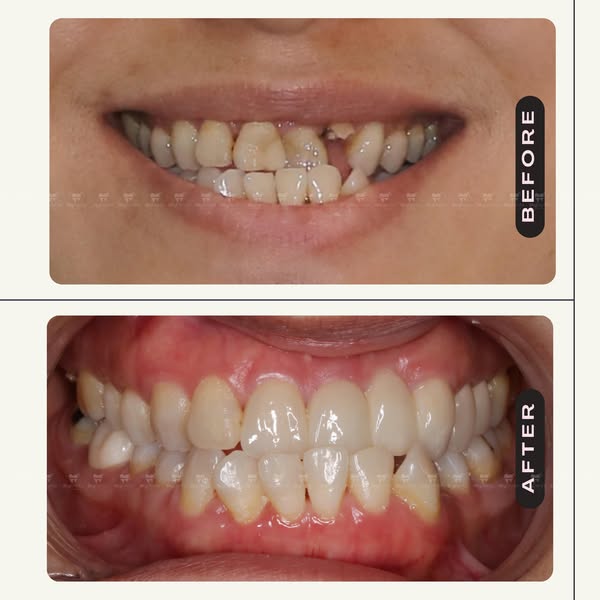 ha khoa Quận Gò Vấp cần TUYỂN DỤNG 