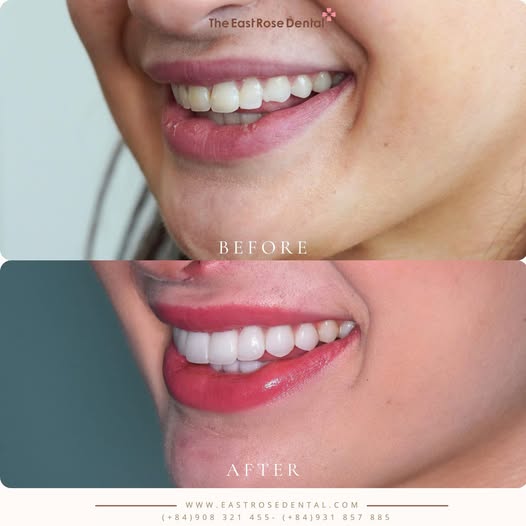 The East Rose Dental hiện đang tìm kiếm bác sĩ Răng Hàm Mặt 