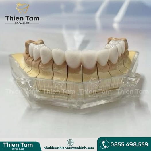  NHA KHOA CẦN TUYỂN: I- VỊ TRÍ:   1. Phụ Điều Trị: