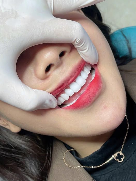 NHA KHOA KIM TRANG cần tuyển. - 02 Phụ tá