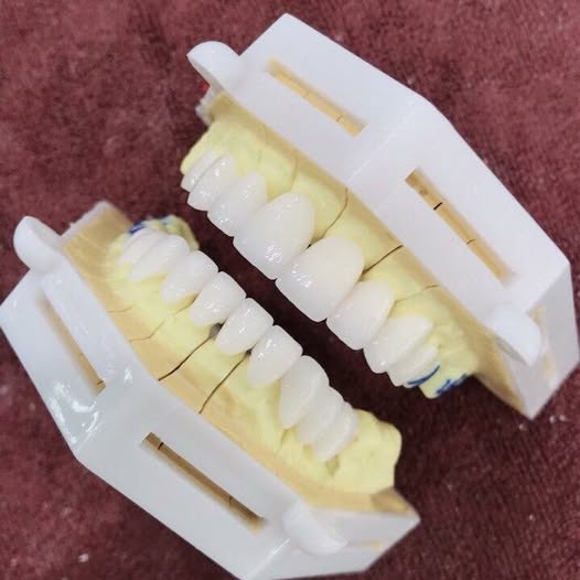 TUYỂN DỤNG : 05 y tá, điều dưỡng