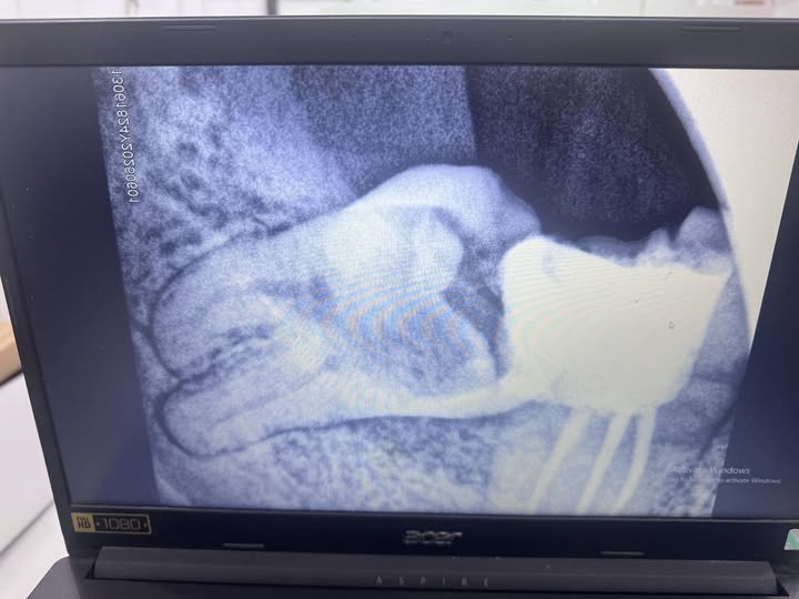 Phòng khám Nha Khoa cần tuyển; - 2 KTV nam đứng ghế chính, đi làm luôn