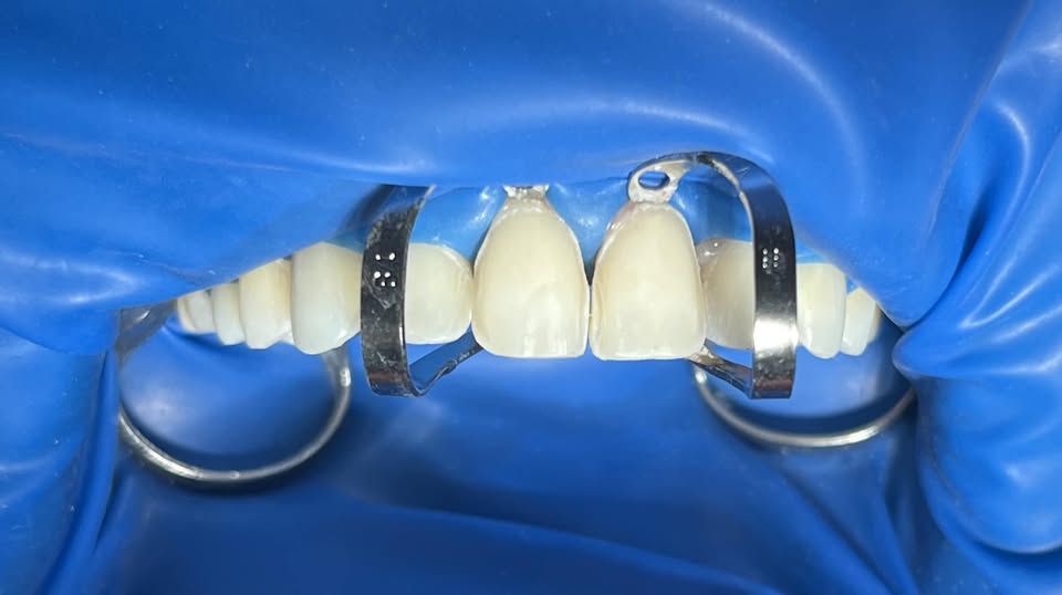 Cần tuyển điều trị làm việc tại quận 12(gần gò vấp)