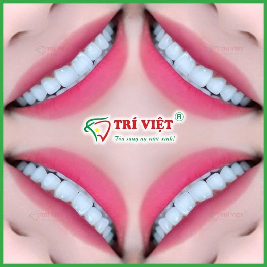 NHA KHOA TRÍ VIỆT tuyển dụng nhân sự làm việc fulltime tại Quận Gò Vấp