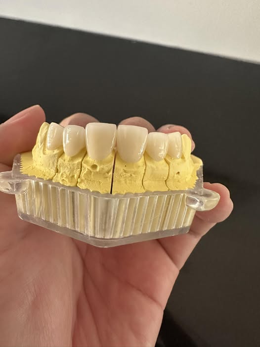 Nha khoa Hoàng Kim cần tuyển: ✅2 Điều trị đứng phòng làm tốt tất cả các thủ thuật