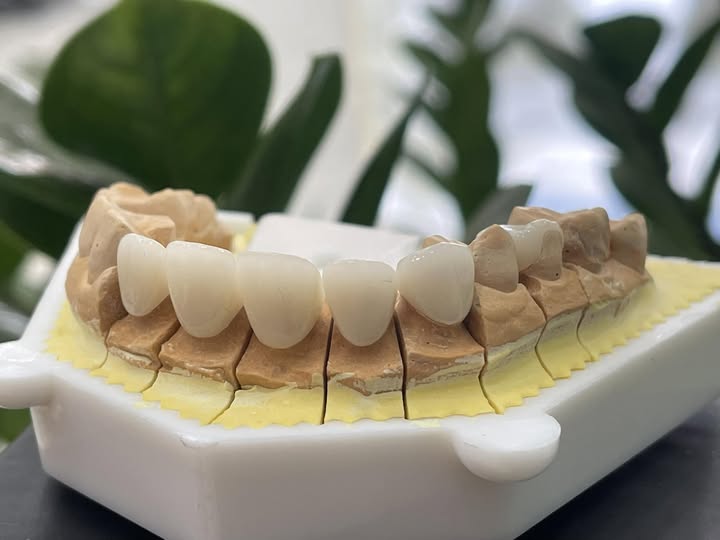  NHA KHOA Á ĐÔNG II - TUYỂN DỤNG PHỤ TÁ