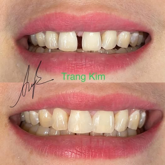 Phòng khám nha khoa cần tuyển 1 ktv (nam) đứng ghế 