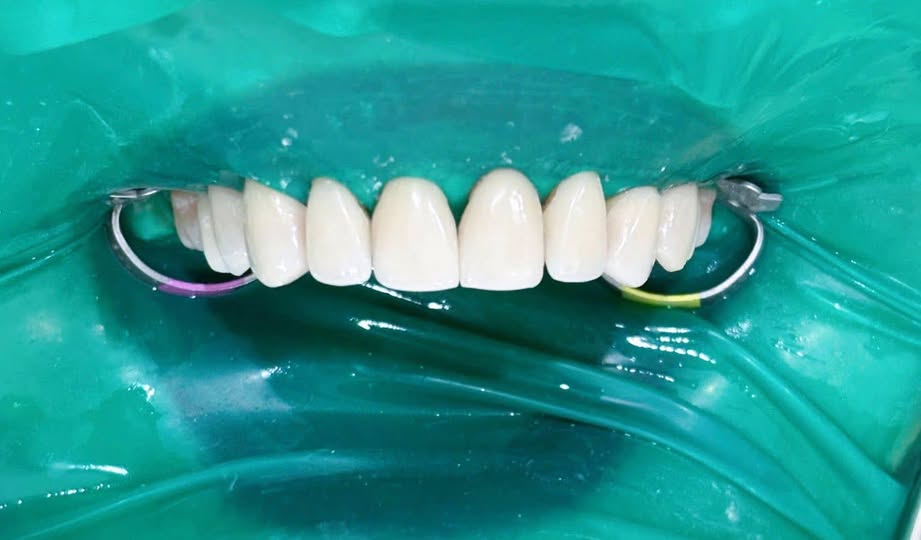 TUYỂN DỤNG ĐIỀU TRỊ VIÊN NHA KHOA - LƯƠNG HẤP DẪN!