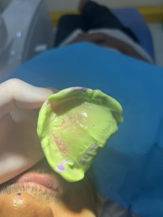 NHA KHOA DR. MINH – TUYỂN DỤNG 🦷 📌 Vị trí cần tuyển:  • 02 Điều trị  • 02 Phụ tá nha khoa  • 02 Nhân viên Sale/CSKH