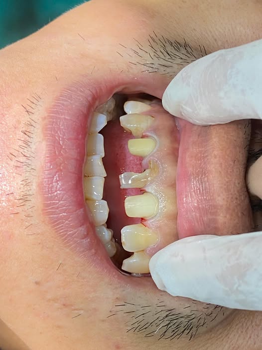 Nha khoa Trần Gia cần tuyển 2 phụ tá.