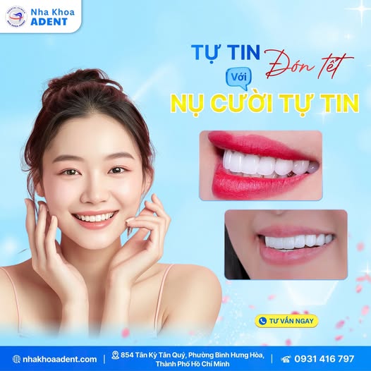 TUYỂN DỤNG PHỤ T&Aacute; NHA KHOA